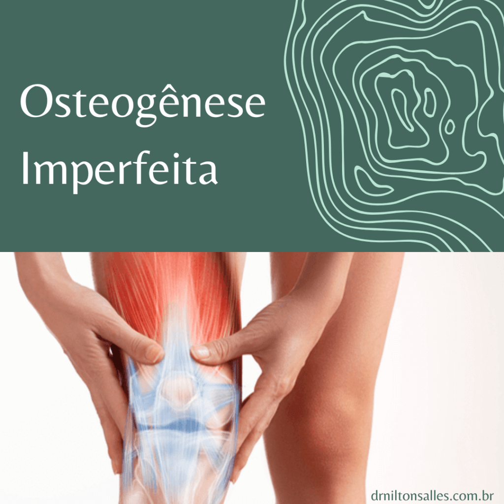 Osteogênese Imperfeita