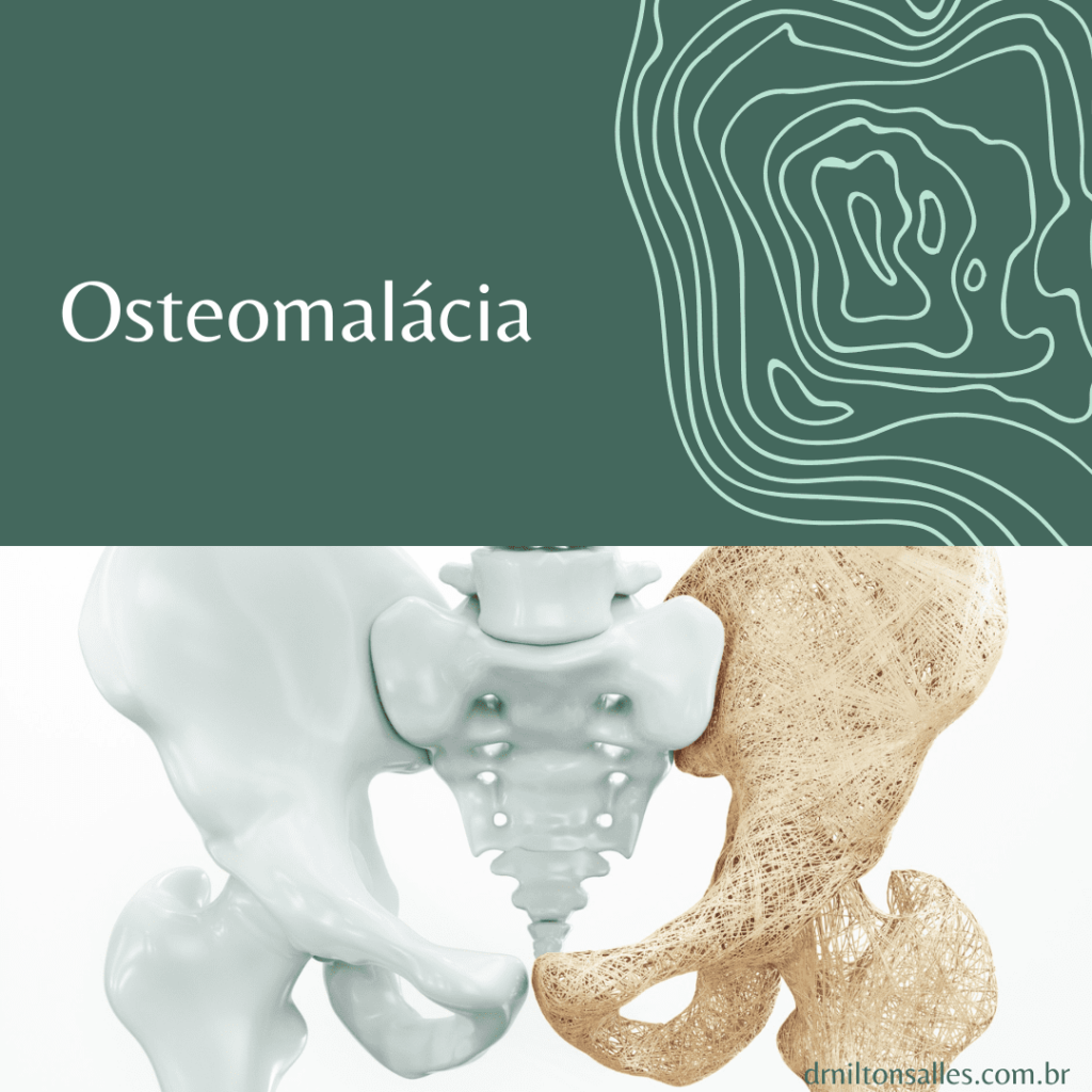 Osteomalácia