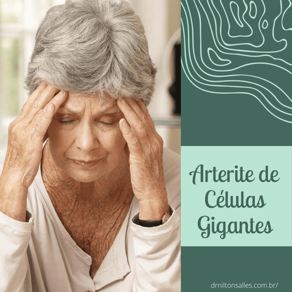 Arterite de Células Gigantes