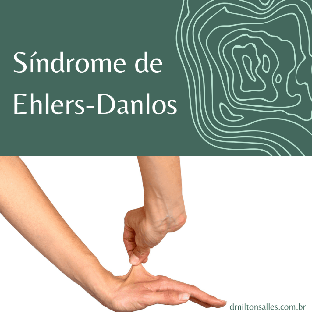 Síndrome de Ehlers-Danlos